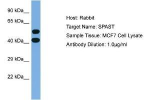 Host: Rabbit Target Name: SPAST Sample Type: MCF7 Whole Cell lysates Antibody Dilution: 1. (Spastin antibody  (Middle Region))