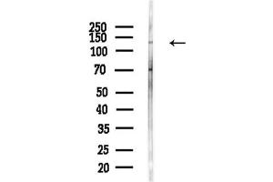 Western blot analysis of lysates from  cells(heat-shock,45 min treatment), using Phospho-HDAC5 (Ser498) Antibody at 1/1000 dilution.