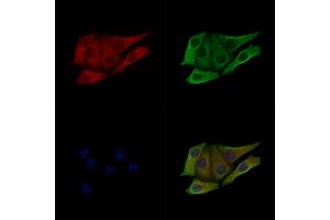ABIN7093244 and ABIN7097261 staining Hela cells(heat shock treatment) by IF/ICC.