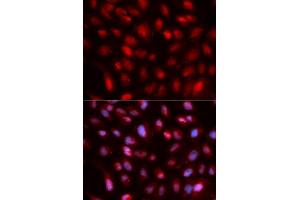 Immunofluorescence analysis of U2OS cell using SUMO2 antibody. (SUMO2 antibody  (AA 1-95))