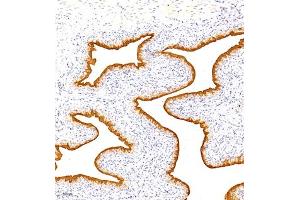 Immunohistochemistry analysis of paraffin embedded rat bladder using TGDS (ABIN7075850) at dilution of 1: 1500 (TGDS antibody)
