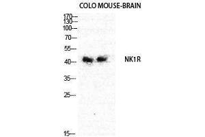 Western Blotting (WB) image for anti-Tachykinin Receptor 1 (TACR1) (Internal Region) antibody (ABIN3176349) (TACR1 antibody  (Internal Region))