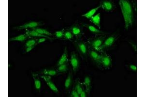 Immunofluorescence staining of Hela cells with ABIN7161386 at 1:133, counter-stained with DAPI. (NPAS2 antibody  (AA 644-763))