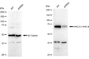 Western blotting analysis using PKC delta + PKC theta antibody (ABIN7799841).