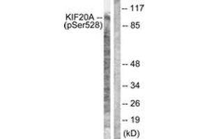 Western blot analysis of extracts from 293 cells, using KIF20A (Phospho-Ser528) Antibody. (KIF20A antibody  (pSer528))