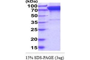 SDS-PAGE (SDS) image for Discoidin Domain Receptor tyrosine Kinase 1 (DDR1) (AA 21-417) protein (hIgG-His-tag) (ABIN6388104) (DDR1 Protein (AA 21-417) (hIgG-His-tag))