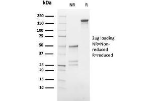 SDS-PAGE Analysis Purified hCG beta Mouse Monoclonal Antibody (HCGb/54). (CGB antibody)