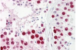 Anti-UBA2 antibody IHC staining of human testis. (UBA2 antibody  (AA 591-640))