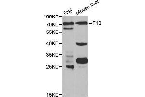 Western blot analysis of extracts of various cell lines, using F10 antibody. (Coagulation Factor X antibody  (AA 235-488))