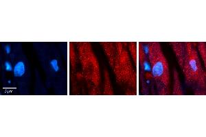 Rabbit Anti-WASL Antibody Catalog Number: ARP63498_P050 Formalin Fixed Paraffin Embedded Tissue: Human heart Tissue Observed Staining: Cytoplasmic Primary Antibody Concentration: 1:100 Other Working Concentrations: N/A Secondary Antibody: Donkey anti-Rabbit-Cy3 Secondary Antibody Concentration: 1:200 Magnification: 20X Exposure Time: 0. (Neural Wiskott-Aldrich syndrome protein (WASL) (Middle Region) antibody)