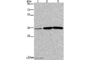 Western blot analysis of Human testis tissue, A549 and PC3 cell, using MAGEA3 Polyclonal Antibody at dilution of 1:400