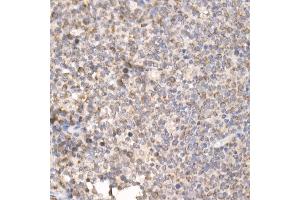 Immunohistochemistry of paraffin-embedded human tonsil using PG Rabbit pAb (ABIN7269317) at dilution of 1:25 (40x lens). (PGAM5 antibody  (AA 30-225))