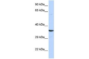 Western Blotting (WB) image for anti-Acidic (Leucine-Rich) Nuclear phosphoprotein 32 Family, Member E (ANP32E) antibody (ABIN2459012)