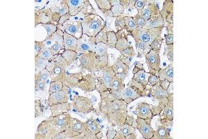 Immunohistochemistry of paraffin-embedded Human liver using UNC13B Rabbit pAb (ABIN7271215) at dilution of 1:100 (40x lens). (UNC13B antibody  (AA 1-350))