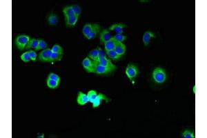 Immunofluorescent analysis of MCF-7 cells using ABIN7172953 at dilution of 1:100 and Alexa Fluor 488-congugated AffiniPure Goat Anti-Rabbit IgG(H+L) (TMCC1 antibody  (AA 51-300))