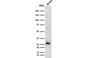 Western Blot Analysis of human Brain tissue lysate using Calretinin Mouse Monoclonal Antibody (CALB2/2602). (Calretinin antibody  (AA 23-242))