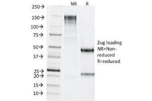 SDS-PAGE Analysis of Purified, BSA-Free TDP2 Antibody (clone TDP2/1258). (TDP2 antibody)