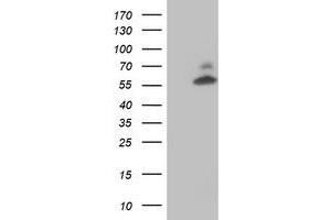 HEK293T cells were transfected with the pCMV6-ENTRY control (Left lane) or pCMV6-ENTRY AKT1 (Right lane) cDNA for 48 hrs and lysed. (AKT1 antibody)