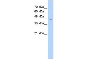 WB Suggested Anti-ASS Antibody Titration:  2. (ASS1 antibody  (C-Term))