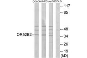 Western blot analysis of extracts from COLO/HuvEc/HepG2 cells, using OR52B2 Antibody.