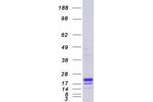 Lymphocyte Antigen 86 (LY86) protein (Myc-DYKDDDDK Tag)