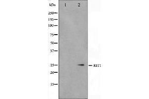 Western blot analysis on Jurkat cell lysate using RIT1 Antibody,The lane on the left is treated with the antigen-specific peptide. (RIT1 antibody  (C-Term))