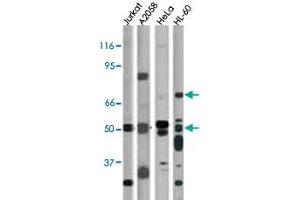 The CHEK1 (phospho S317) polyclonal antibody  is used in Western blot for detection in, from left to right, Jurkat, A-2058, Hela, and HL-60 cell lysates. (CHEK1 antibody  (pSer317))