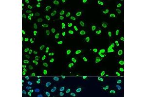 Immunofluorescence analysis of U2OS cells using DiMethyl-DNMT3A-K44 Polyclonal Antibody at dilution of 1:100. (DNMT3A antibody  (2meLys44))