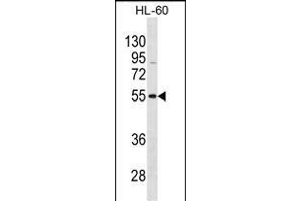 VIPR1 抗体  (C-Term)