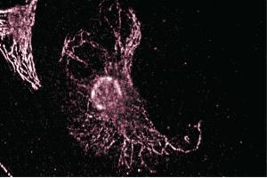 Immunofluorescent staining of NRK cells. (TRIP10 antibody  (AA 411-501))
