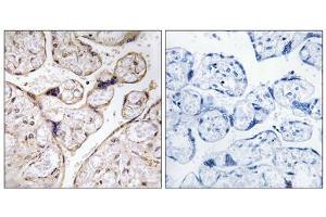 Immunohistochemistry analysis of paraffin-embedded human placenta tissue using PHCA antibody. (ACER3 antibody  (Internal Region))