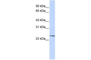 WB Suggested Anti-SSX6 Antibody Titration:  0. (SSX6 antibody  (Middle Region))