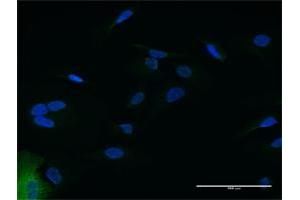 Immunofluorescence of purified MaxPab antibody to IFIT2 on HeLa cell.