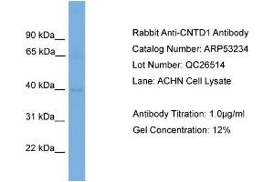 WB Suggested Anti-CNTD1  Antibody Titration: 0. (CNTD1 antibody  (N-Term))