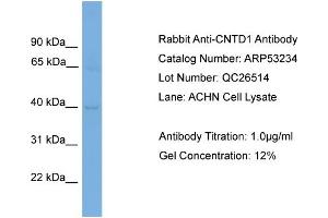 WB Suggested Anti-CNTD1  Antibody Titration: 0.