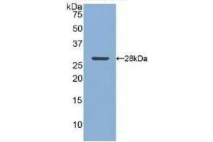 Detection of Recombinant CLU, Human using Polyclonal Antibody to Clusterin (CLU) (Clusterin antibody  (AA 228-449))