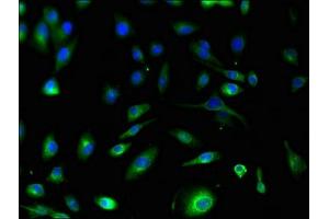 Immunofluorescent analysis of U251 cells using ABIN7166034 at dilution of 1:100 and Alexa Fluor 488-congugated AffiniPure Goat Anti-Rabbit IgG(H+L) (S1A1 (AA 2-97) antibody)