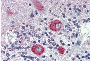 Human Brain, cerebellum: Formalin-Fixed, Paraffin-Embedded (FFPE) (GRHL2 antibody  (C-Term))