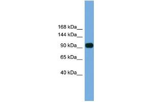 WB Suggested Anti-Parp8 Antibody Titration: 0. (PARP8 antibody  (N-Term))