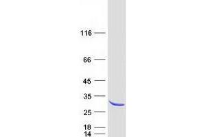 Western Blotting (WB) image for YKT6 V-SNARE Homolog (YKT6) protein (Myc-DYKDDDDK Tag) (ABIN2735724)