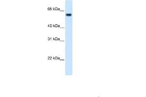 WB Suggested Anti-FTCD Antibody  Titration: 1. (FTCD antibody  (N-Term))