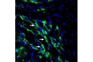 Expression of SLC6A14 in mouse RTN - Immunohistochemical staining of perfusion-fixed frozen mouse brain sections with Anti-SLC6A14 (extracellular) Antibody (ABIN7043737, ABIN7044477 and ABIN7044478), (1:200), followed by goat-anti-rabbit-AlexaFluor-488. (Slc6a14 antibody  (2nd Extracellular Loop))