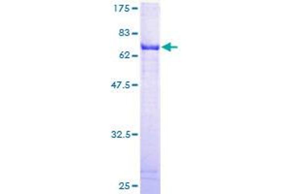 ALDH3B2 Protein (AA 1-385) (GST tag)