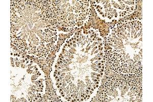 ABIN7096114 and ABIN7100176 at 1/100 staining rat testis tissue by IHC-P. (PYM antibody)