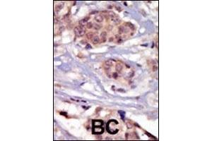 Immunohistochemistry (Paraffin-embedded Sections) (IHC (p)) image for anti-FYN Oncogene Related To SRC, FGR, YES (FYN) (AA 13-43), (N-Term) antibody (ABIN392098)