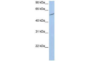 RIOK3 antibody used at 1 ug/ml to detect target protein. (RIOK3 antibody)