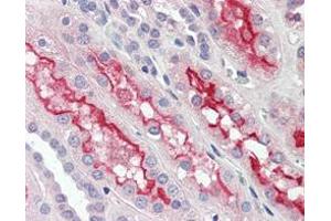 Immunohistochemical analysis of paraffin-embedded human kidney tissues using FER mouse mAb. (FER antibody)