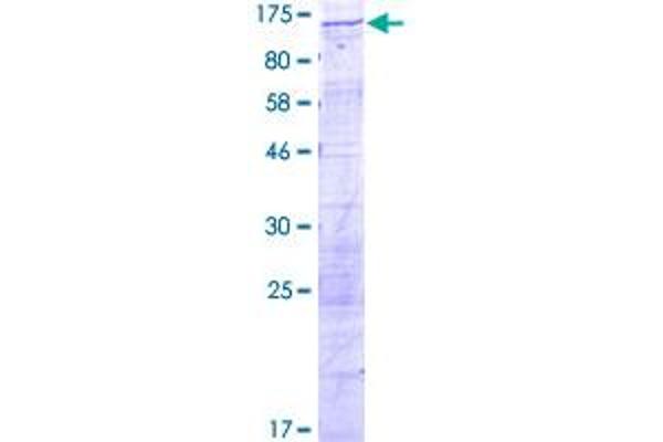 DDX10 Protein (AA 1-875) (GST tag)
