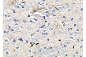 ABIN6257242 and ABIN6273630 at 1/100 staining Rat brain tissue by IHC-P.