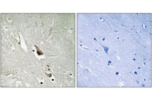 Immunohistochemistry analysis of paraffin-embedded human brain, using MAP3K7 (Phospho-Ser439) Antibody. (MAP3K7 antibody  (pSer439))